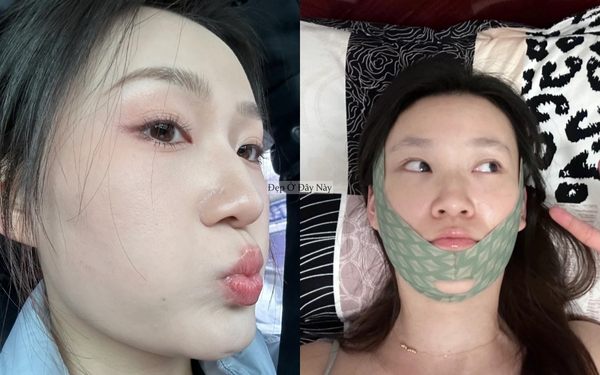 Trước Tết 7 ng&agrave;y, t&ocirc;i l&agrave;m đ&uacute;ng 5 việc n&agrave;y để mặt gọn lại v&agrave; da căng b&oacute;ng hơn hẳn- Ảnh 3.