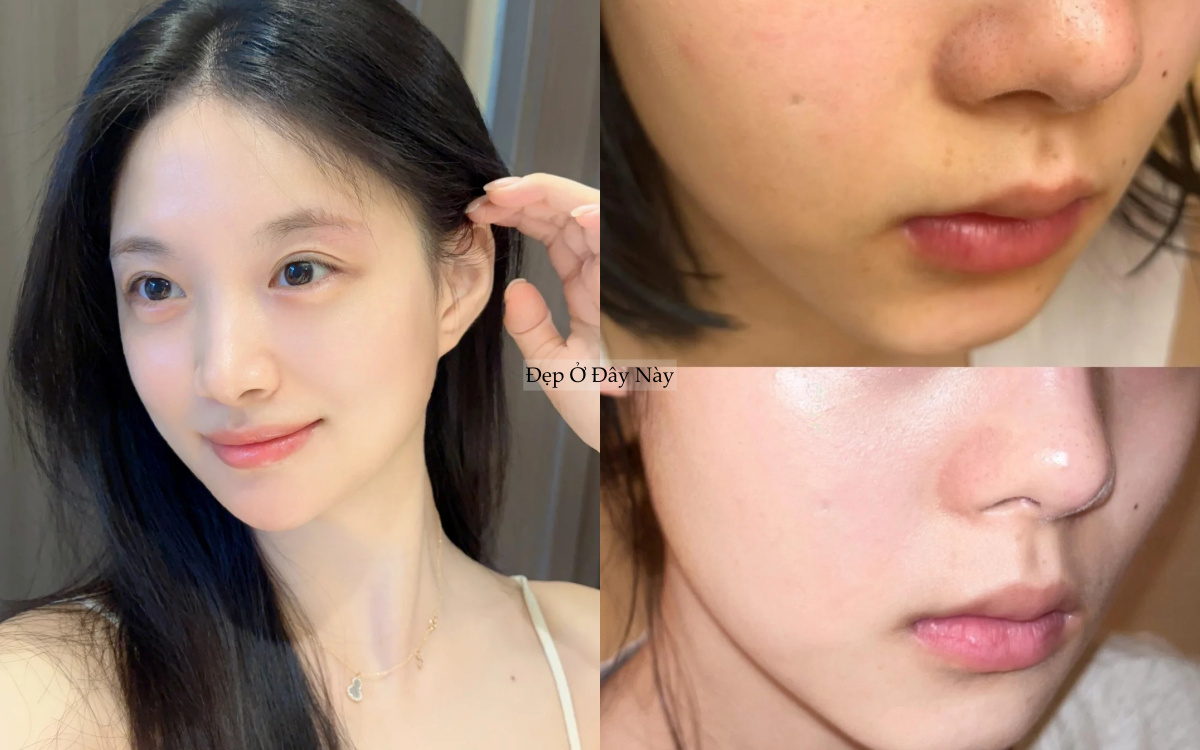 Từ giờ đến Tết đừng dại d&ugrave;ng những m&oacute;n mỹ phẩm n&agrave;y nếu kh&ocirc;ng muốn da "toang" ph&uacute;t ch&oacute;t- Ảnh 3.