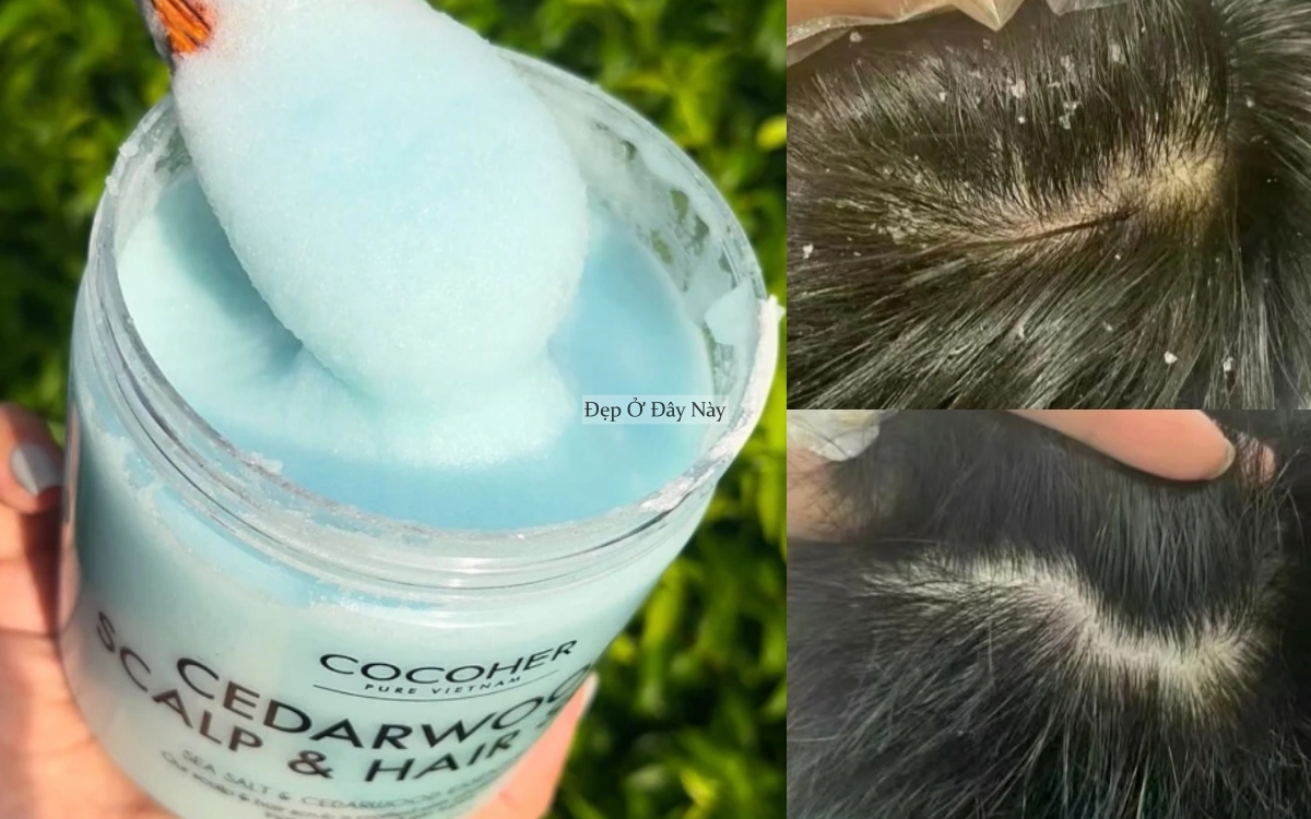 5 bước gội đầu đơn giản nhưng giúp tóc suôn mượt hơn hẳn- Ảnh 2. 5 bước gội đầu đơn giản nhưng giúp tóc suôn mượt hơn hẳn- Ảnh 2.