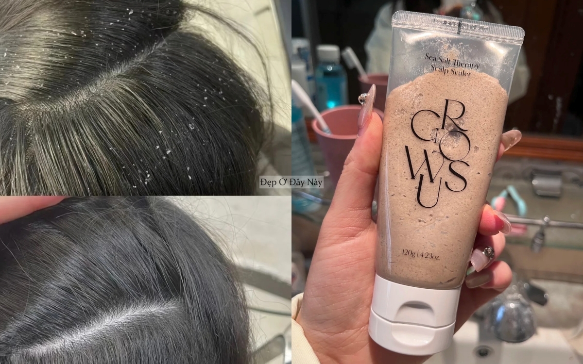 Muốn tóc mọc nhanh, khỏe và dày hơn thì nhất định phải sử dụng 5 sản phẩm này- Ảnh 2. Muốn tóc mọc nhanh, khỏe và dày hơn thì nhất định phải sử dụng 5 sản phẩm này- Ảnh 2.