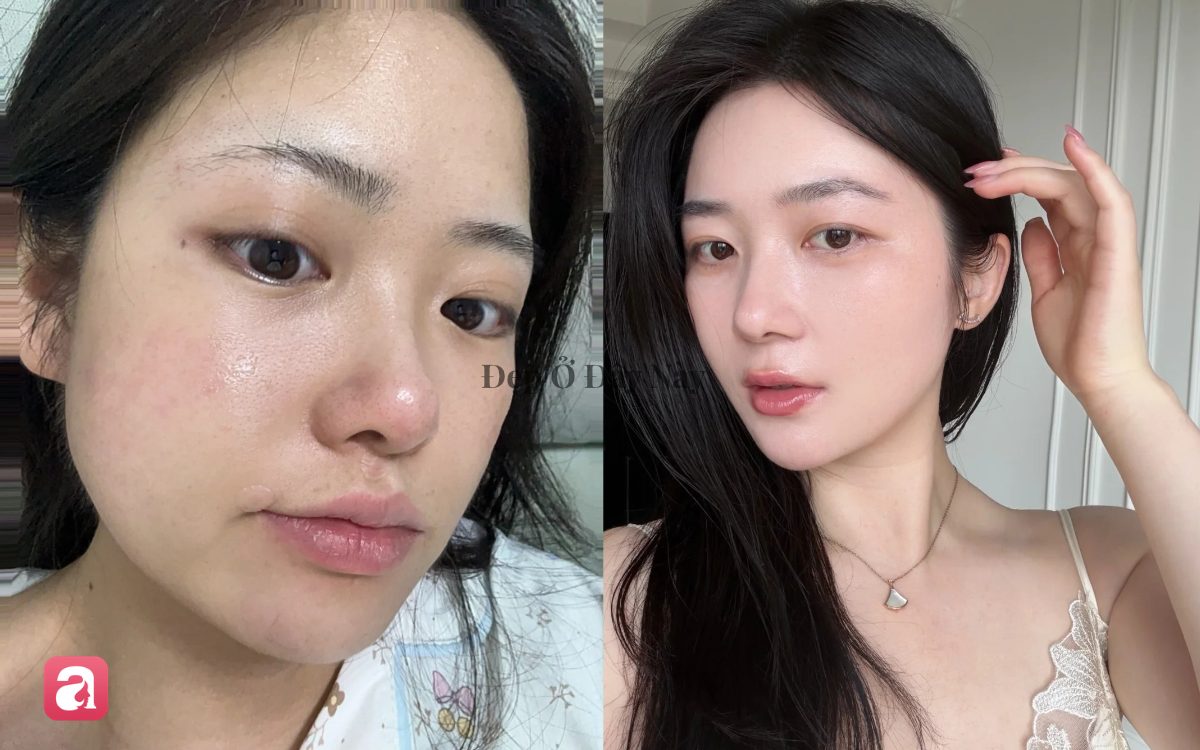 Vì sao da lão hóa và mất collagen nhanh, lộ rõ nếp nhăn vào mùa thu? - Ảnh 1.