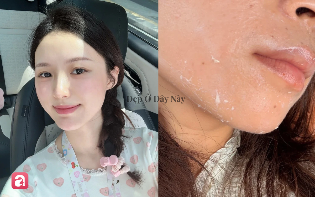 V&igrave; sao thoa kem chống nắng hay bị v&oacute;n cục v&agrave; để lại vệt trắng tr&ecirc;n da v&agrave;o m&ugrave;a thu?- Ảnh 1.