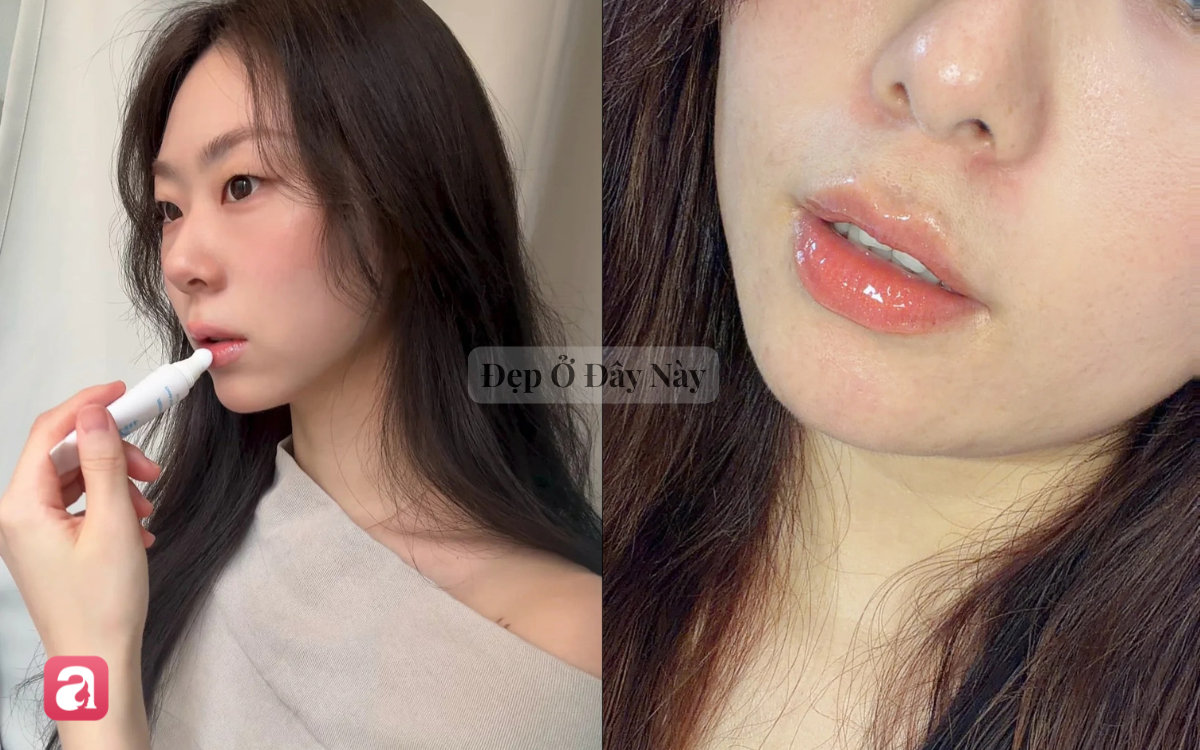 Nhỏ 2 giọt serum trước son dưỡng, bờ m&ocirc;i kh&ocirc; tr&oacute;c của t&ocirc;i đ&atilde; mềm mượt hơn bao giờ hết - Ảnh 1.