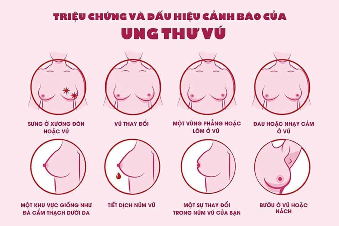 Mắc ung thư vú giai đoạn 4 ở tuổi 34, cuộc sống của cựu nữ chính The Bachelorette sau 2 năm khiến nhiều người xúc động- Ảnh 6.