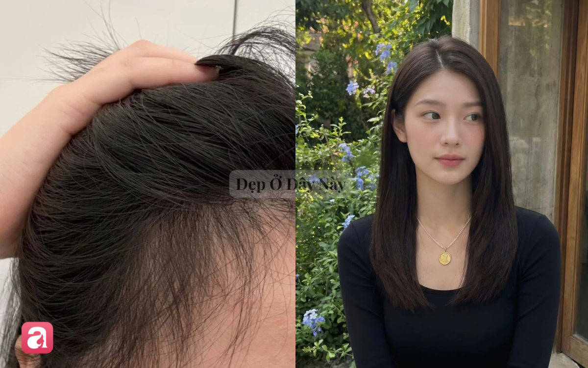 T&oacute;c mọc tua tủa, chắc khỏe hơn nhờ 5 serum dưỡng thảo mộc vừa tốt vừa thơm - Ảnh 1.