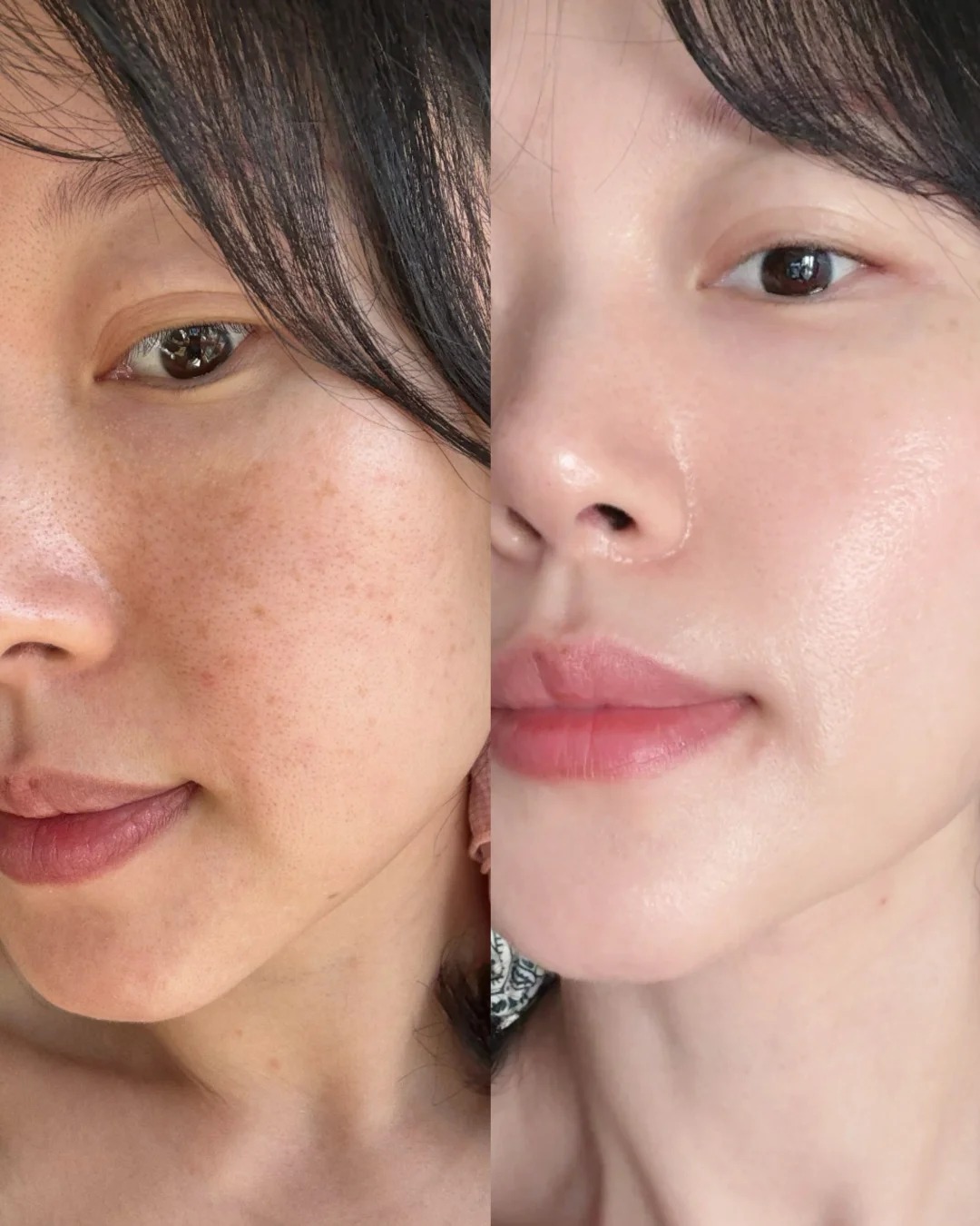 Da xỉn m&agrave;u, k&eacute;m đều m&agrave;u ở tuổi 35+: C&oacute; thể chu tr&igrave;nh chăm s&oacute;c của bạn đang thiếu bước n&agrave;y - Ảnh 1.