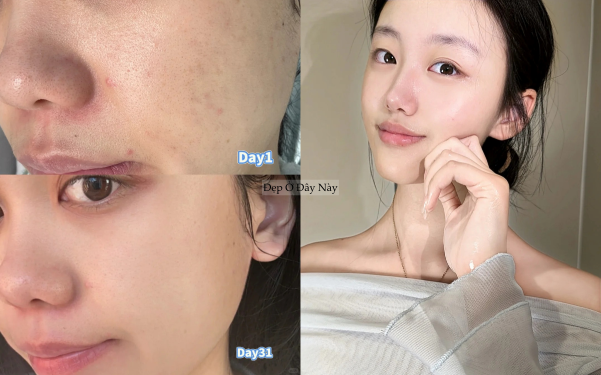 5 chiêu "vàng ngọc" khi dùng serum giúp làn da tuổi 25+ luôn khỏe đẹp - Ảnh 1.