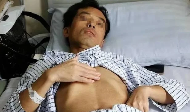 Người đ&agrave;n &ocirc;ng mắc ung thư gan v&igrave; ng&agrave;y n&agrave;o cũng uống nước từ loại cốc nhiều người d&ugrave;ng mỗi ng&agrave;y- Ảnh 1.