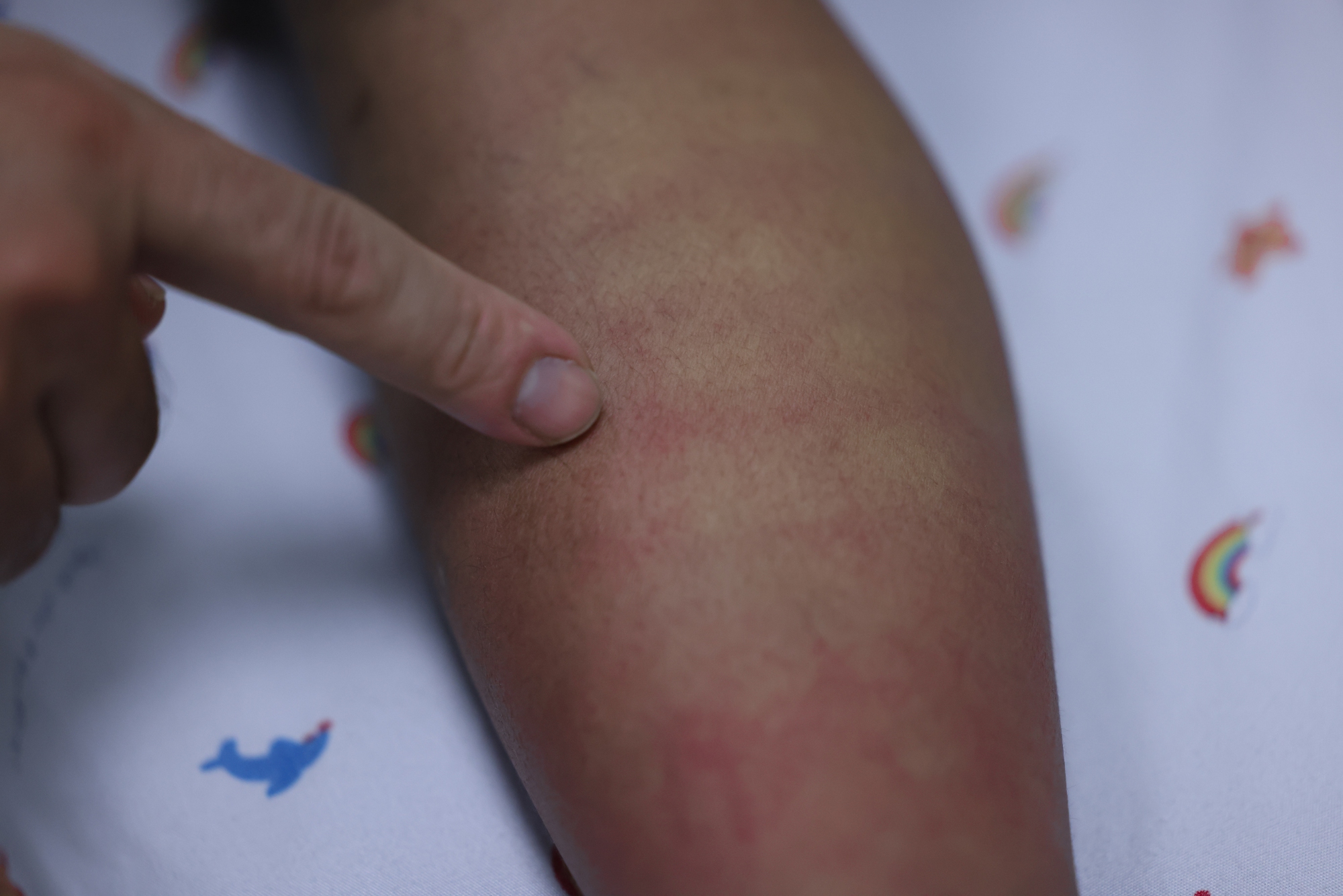 Những “màu đỏ không Tết” do Sốt xuất huyết Dengue và cuộc chiến giành lại mùa xuân - Ảnh 17.