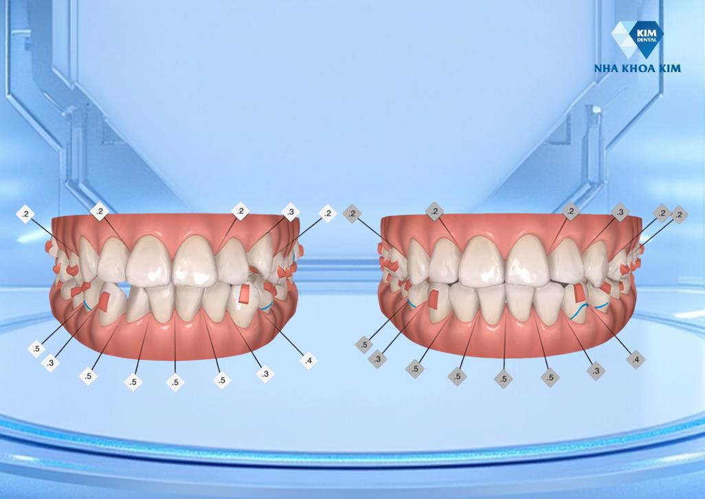 Tại sao giới trẻ ng&agrave;y nay chỉ tin l&agrave;m răng tại c&aacute;c hệ thống nha khoa nổi tiếng?- Ảnh 3.