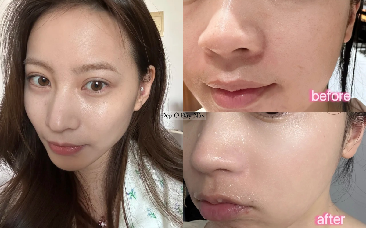 T&aacute;i sinh l&agrave;n da trong giấc ngủ với 5 lọ serum đ&ecirc;m gi&aacute; b&igrave;nh d&acirc;n ai d&ugrave;ng cũng khen - Ảnh 1.