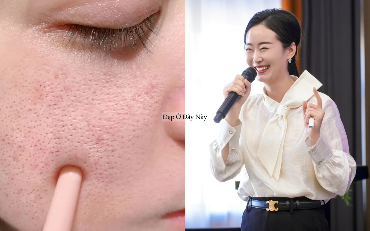 Chuy&ecirc;n gia chỉ ra: C&oacute; tới 4 loại lỗ ch&acirc;n l&ocirc;ng to v&agrave; c&aacute;ch khắc phục hiệu quả nhất - Ảnh 1.