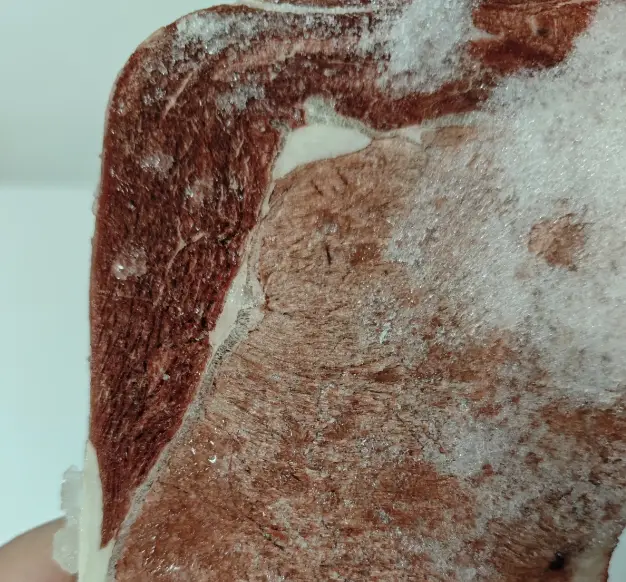 Thịt để tủ đ&aacute; tr&ocirc;ng như thế n&agrave;y tốt nhất n&ecirc;n vứt đi, cho trẻ con ăn c&agrave;ng nguy hiểm! - Ảnh 2.