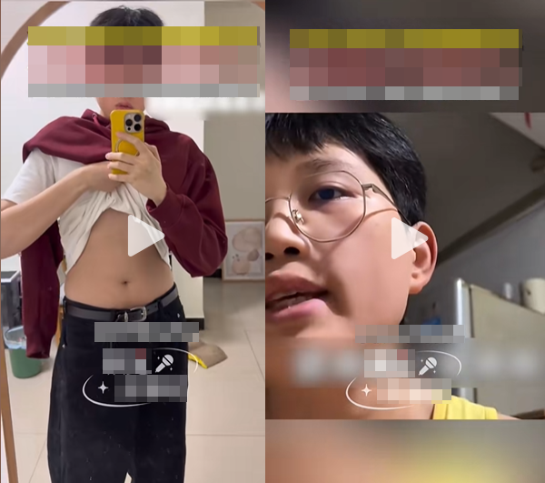 Nam thanh ni&ecirc;n 32 tuổi bỗng "dậy th&igrave;", ph&aacute;t triển ngực như phụ nữ, b&aacute;c sĩ sốc khi nồng độ hormone nam chỉ dưới 0.1 - Ảnh 1.