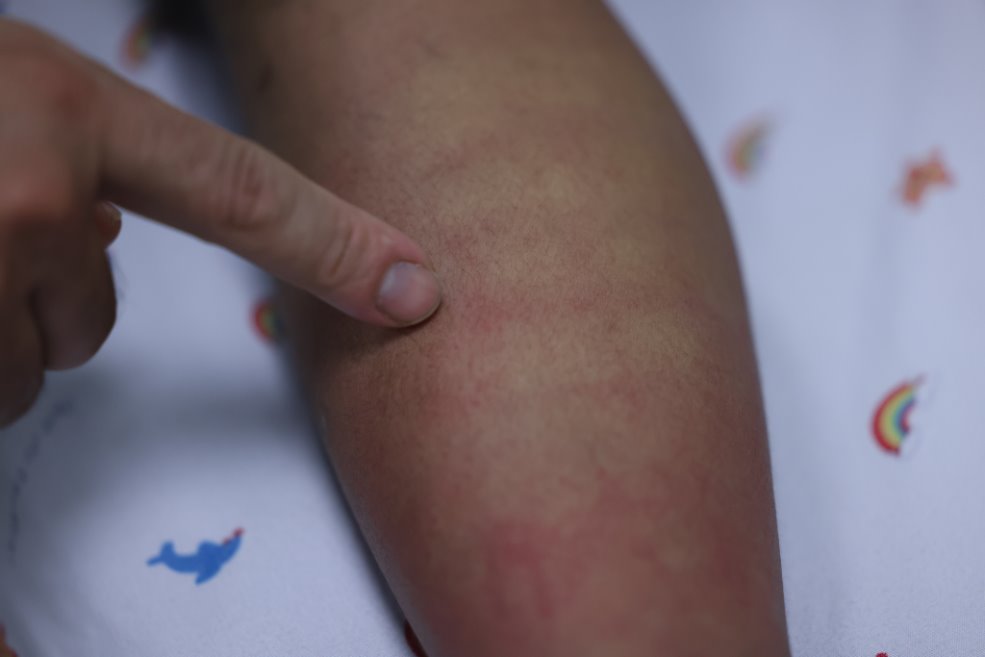 Sốt xuất huyết Dengue v&agrave; những dự định dở dang b&ecirc;n giường bệnh - Ảnh 2.