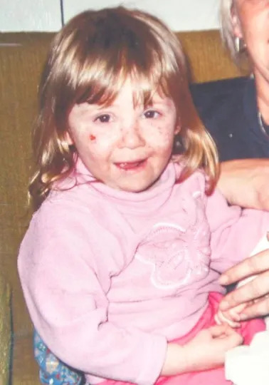 Bi kịch "c&ocirc; b&eacute; ma c&agrave; rồng" đời thực - Ảnh 2.