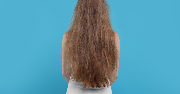 T&oacute;c kh&ocirc; xơ sau gội: C&oacute; thể bạn đang bỏ qua bước chăm s&oacute;c quan trọng n&agrave;y - Ảnh 1.