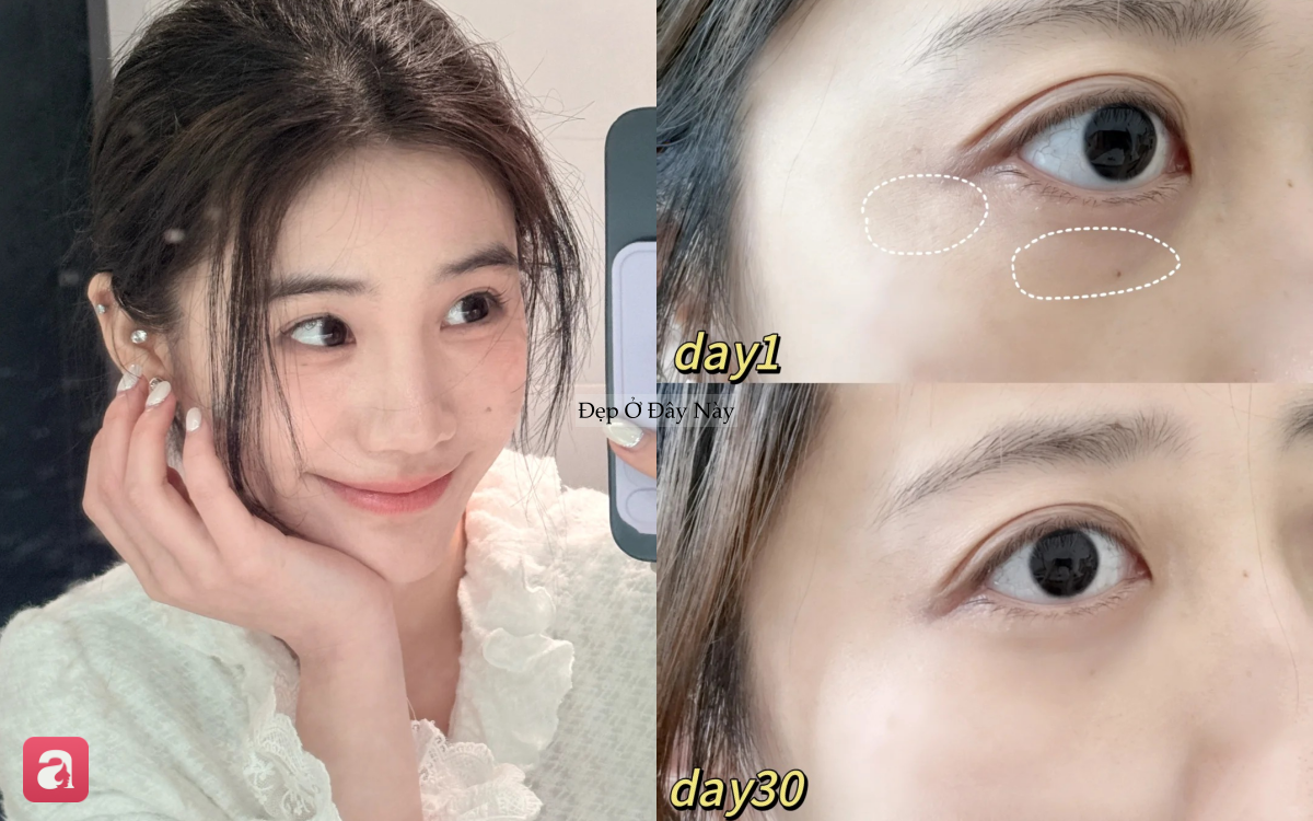 5 kem dưỡng mắt ki&ecirc;m thanh massage gi&uacute;p ngừa l&atilde;o h&oacute;a hiệu quả, d&ugrave;ng một lần l&agrave; "m&ecirc;" - Ảnh 1.