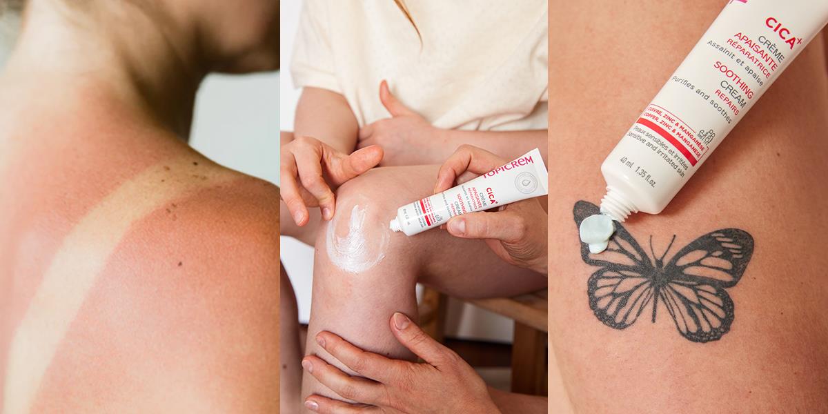 Sống nhanh, da cũng &ldquo;đuối&rdquo;: Đ&acirc;u l&agrave; giải ph&aacute;p phục hồi cho l&agrave;n da thương tổn? - Ảnh 2.