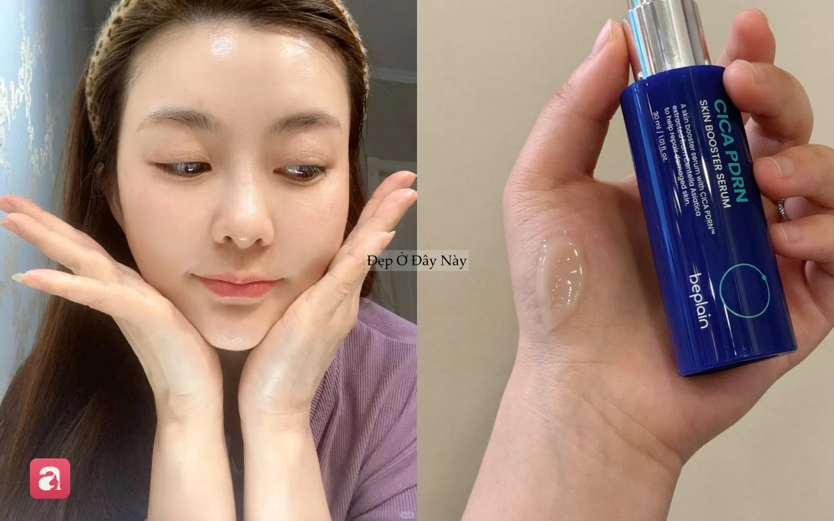 Đi ngủ sớm v&agrave; b&ocirc;i thứ n&agrave;y l&ecirc;n da mỗi tối, l&agrave;n da của t&ocirc;i sau 1 th&aacute;ng đ&atilde; thay đổi ho&agrave;n to&agrave;n- Ảnh 4.