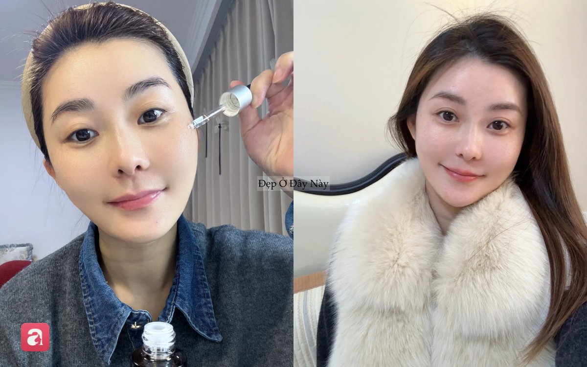 Đi ngủ sớm v&agrave; b&ocirc;i thứ n&agrave;y l&ecirc;n da mỗi tối, l&agrave;n da của t&ocirc;i sau 1 th&aacute;ng đ&atilde; thay đổi ho&agrave;n to&agrave;n- Ảnh 5.