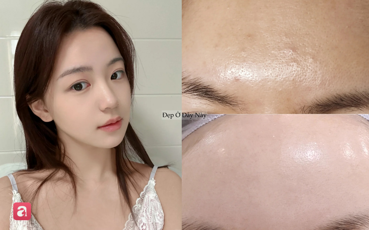 &Iacute;t ai biết: Toner acid c&oacute; thể gi&uacute;p giảm mụn, khử m&ugrave;i v&agrave; l&agrave;m s&aacute;ng da từ đầu tới ch&acirc;n - Ảnh 2.