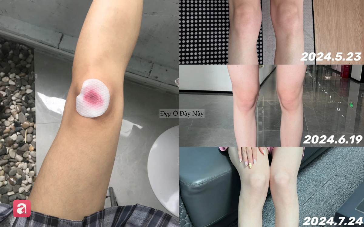 &Iacute;t ai biết: Toner acid c&oacute; thể gi&uacute;p giảm mụn, khử m&ugrave;i v&agrave; l&agrave;m s&aacute;ng da từ đầu tới ch&acirc;n - Ảnh 5.