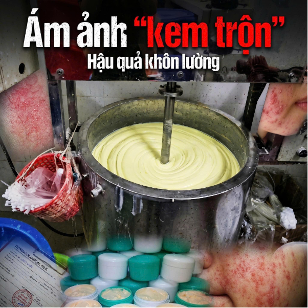 Phụ nữ 25+ nên chọn kem dưỡng collagen giúp ngăn ngừa lão hóa da- Ảnh 1. Phụ nữ 25+ nên chọn kem dưỡng collagen giúp ngăn ngừa lão hóa da- Ảnh 1.