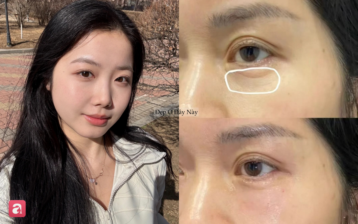 5 lọ kem mắt chứa retinol là "thần dược" cho những nàng ngoài 30 tuổi- Ảnh 1. 5 lọ kem mắt chứa retinol là "thần dược" cho những nàng ngoài 30 tuổi- Ảnh 1.