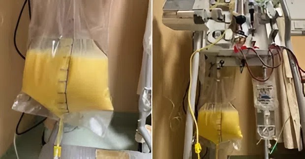 Người phụ nữ ra &ldquo;m&aacute;u trắng như sữa&rdquo;, b&aacute;c sĩ l&ecirc;n tiếng cảnh b&aacute;o - Ảnh 1.