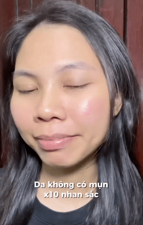 H&agrave;nh tr&igrave;nh dưỡng kh&iacute; huyết "cứu" da hư tổn của c&ocirc; n&agrave;ng tuổi 30: Từng &ldquo;toang&rdquo; v&igrave; peel da, giờ da dẻ hồng h&agrave;o, căng mịn, khỏe từ b&ecirc;n trong- Ảnh 17.