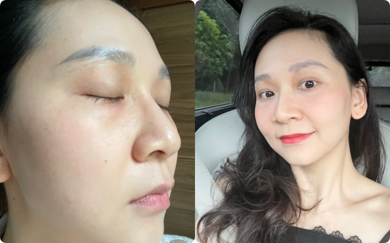 Kh&ocirc;ng d&ugrave;ng retinol, đ&acirc;y l&agrave; l&agrave;n da tuổi 36 của t&ocirc;i khi d&ugrave;ng 3 loại serum n&agrave;y- Ảnh 3.