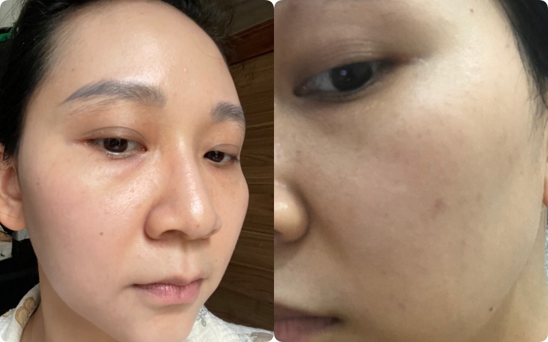 Kh&ocirc;ng d&ugrave;ng retinol, đ&acirc;y l&agrave; l&agrave;n da tuổi 36 của t&ocirc;i khi d&ugrave;ng 3 loại serum n&agrave;y- Ảnh 1.