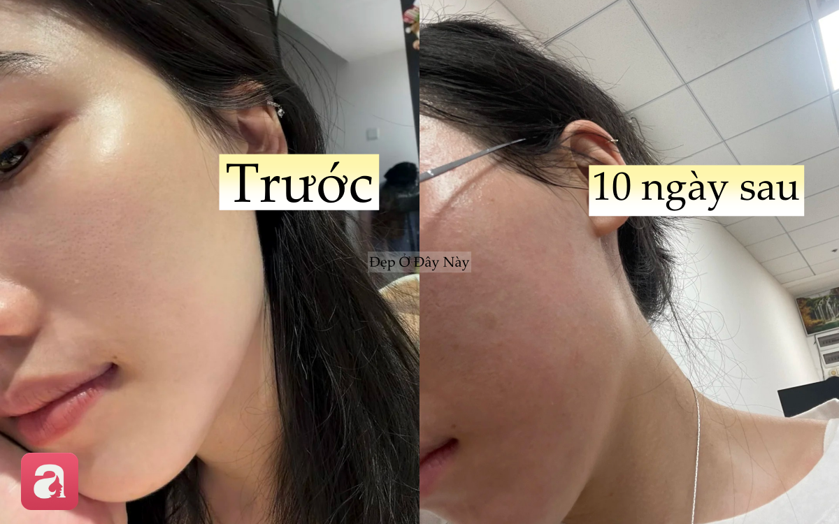 Thử th&aacute;ch kh&ocirc;ng rửa mặt trong 10 ng&agrave;y, c&ocirc; n&agrave;ng nhận kết quả "kh&ocirc;ng như mơ"- Ảnh 3.