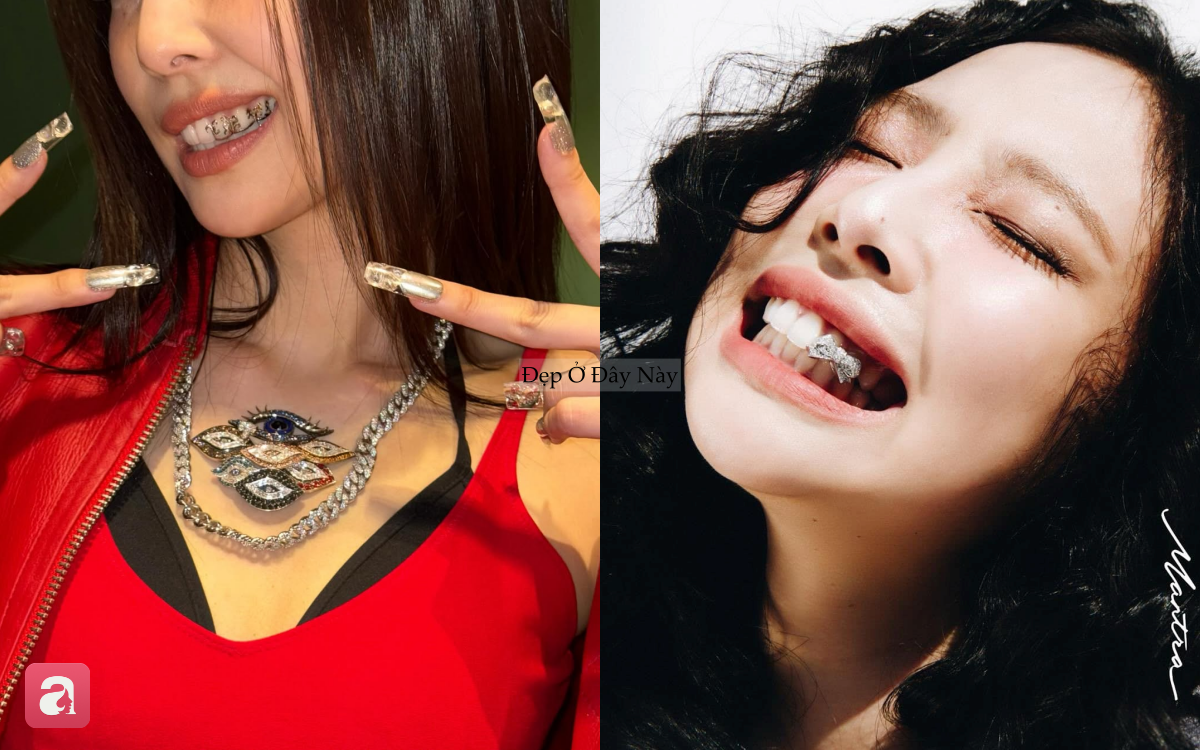 Chiếc bọc răng của Jennie c&oacute; g&igrave; đặc biệt m&agrave; khiến fan ch&uacute; &yacute; hơn cả v&ograve;ng cổ 1,2 tỷ đồng? - Ảnh 6.