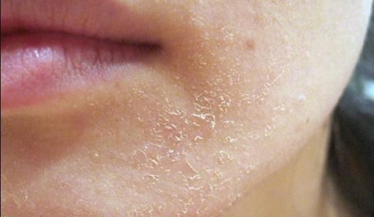 Kem chống nắng cho da mụn đến da dầu, da kh&ocirc;...: Đ&acirc;y l&agrave; những sản phẩm được chuy&ecirc;n gia da liễu H&agrave;n Quốc đ&aacute;nh gi&aacute; cao - Ảnh 3.