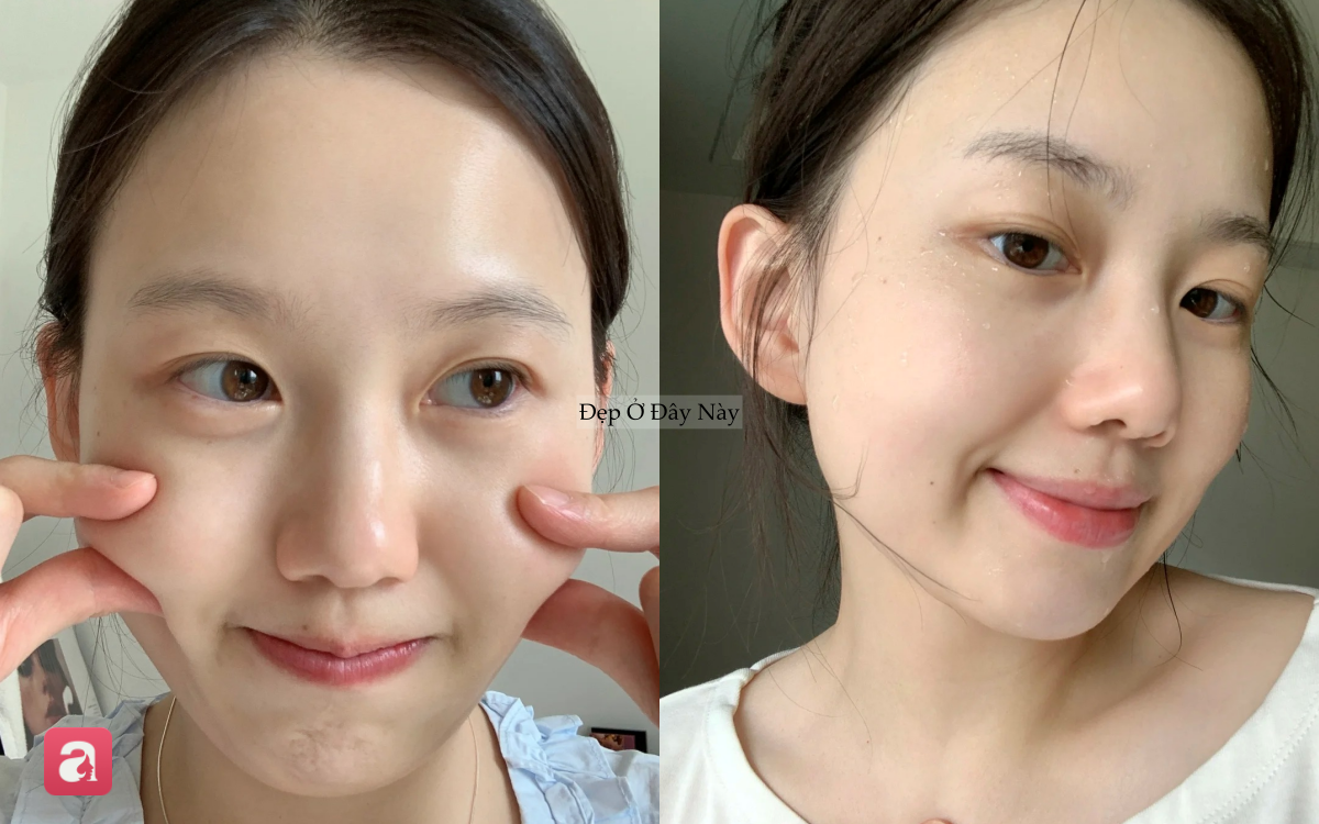Bác sĩ da liễu chỉ ra cách rửa mặt giúp da đẹp lên thấy rõ chỉ sau 30 giây- Ảnh 4. Bác sĩ da liễu chỉ ra cách rửa mặt giúp da đẹp lên thấy rõ chỉ sau 30 giây- Ảnh 4.