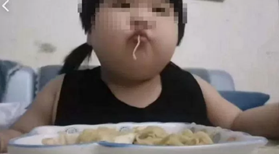Bé gái 8 tuổi đã nặng 45kg, gan nhiễm mỡ nặng vì mỗi bữa đều ăn quá nhiều 1 món mâm cơm gia đình nào cũng có- Ảnh 1. Bé gái 8 tuổi đã nặng 45kg, gan nhiễm mỡ nặng vì mỗi bữa đều ăn quá nhiều 1 món mâm cơm gia đình nào cũng có- Ảnh 1.