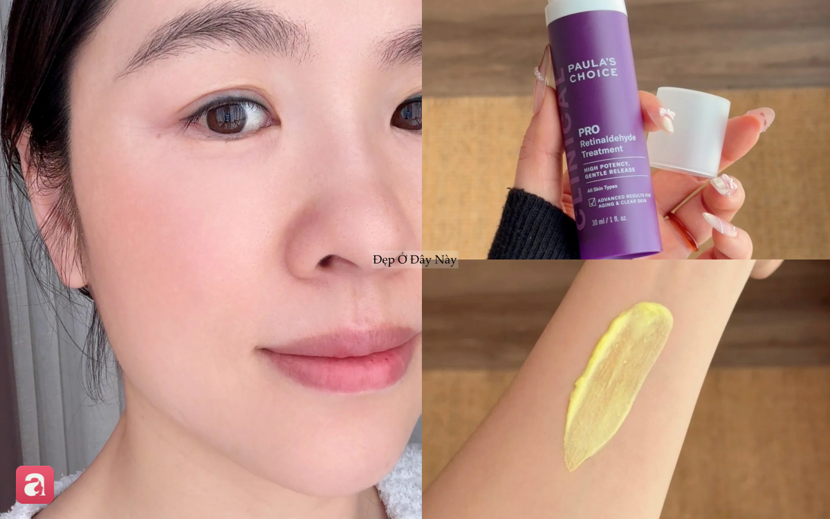 Kh&ocirc;ng phải đầu tư v&agrave;o retinol, đ&acirc;y l&agrave; 6 bước chống l&atilde;o h&oacute;a quan trọng nhất theo b&aacute;c sĩ da liễu - Ảnh 3.
