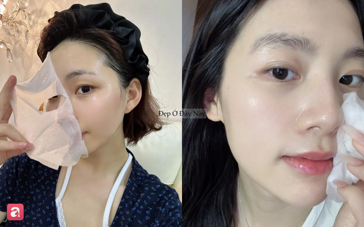 Bác sĩ da liễu tiết lộ: Đắp mặt nạ mỗi ngày chưa chắc đã tốt cho da - Ảnh 3.