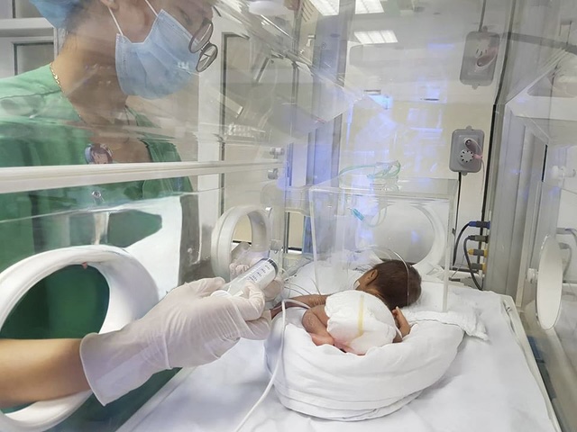 Kỳ tích từ sự phối hợp phản ứng nhanh: Bệnh viện Đa khoa Bình Tân cấp cứu thành công bé sinh cực non chỉ 23 tuần tuổi - Ảnh 1.