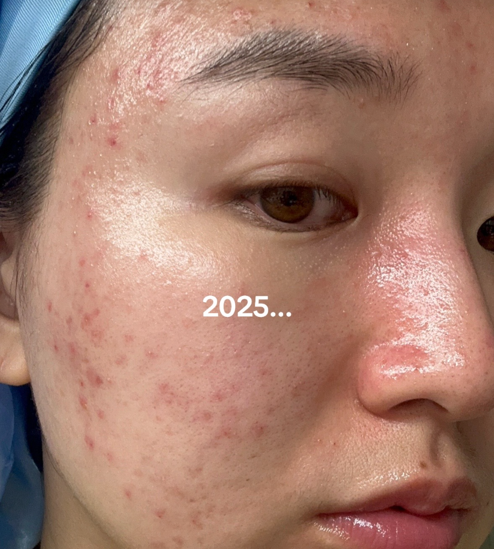Không chạy theo retinol, phụ nữ Hàn lại tin dùng tuýp kem dưỡng đạt 4,5* trên Amazon - Ảnh 10.