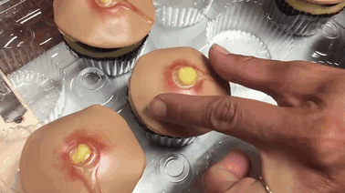 Vì sao nặn mụn hay ngoáy tai lại mang lại cảm giác sướng kỳ lạ đến thế? - Ảnh 3.