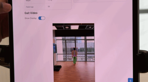 Apple giúp hiện thực hoá điều tưởng chừng không thể: đưa cả một phòng lab phân tích dáng đi vào iPad Pro - Ảnh 5.