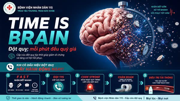 Hành trình giành lại sự sống cho bệnh nhân đột quỵ nặng: Khi ranh giới địa lý được xóa bỏ - Ảnh 2.