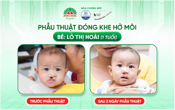 Vượt gần 300km từ Sơn La xuống H&agrave; Nội, ba mẹ đi t&igrave;m nụ cười trọn vẹn cho con - Ảnh 3.