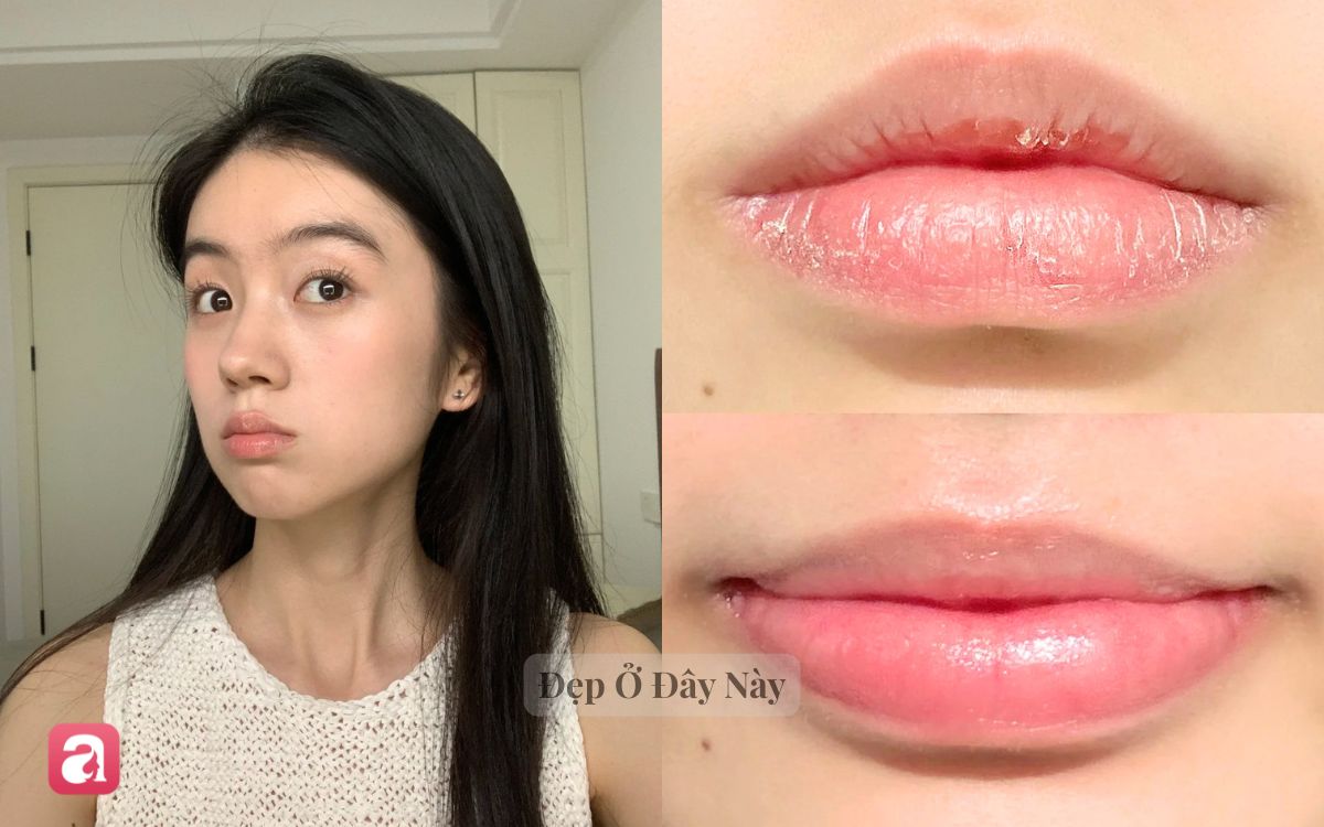 Mỗi tối b&ocirc;i thứ n&agrave;y, m&ocirc;i sẽ căng mọng hồng h&agrave;o chẳng cần t&ocirc; son- Ảnh 1.