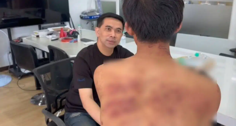 Thanh niên đi làm với mình mẩy thâm tím, sếp hỏi chuyện mới phát hiện nhân viên bị mẹ kế bạo hành - Ảnh 1.