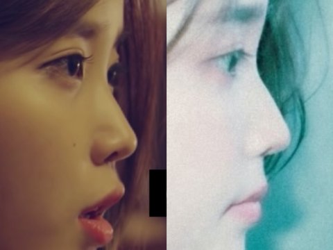IU tranh thủ "dao kéo" nâng cấp nhan sắc sau khi chia tay Lee Jong Suk?- Ảnh 2.
