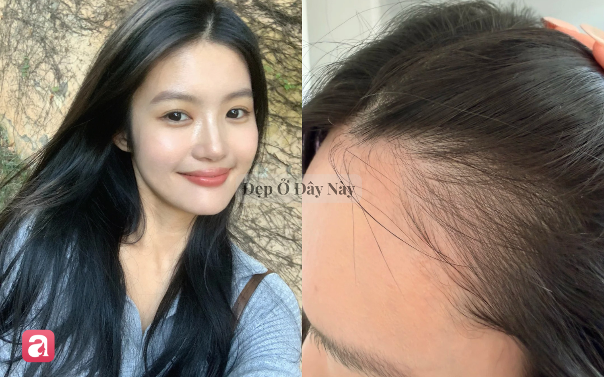 5 lọ dưỡng t&oacute;c bưởi "made in Vietnam" k&iacute;ch th&iacute;ch t&oacute;c mọc nhanh, giảm g&atilde;y rụng thấy r&otilde; - Ảnh 6.